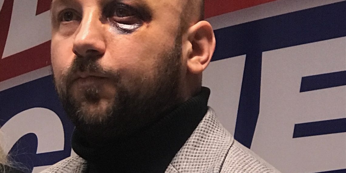 Prebijanje Vidovića sekretara Gradskog odbora SNS -a najgnusniji je čin nasilja poručili kraljevački naprednjaci